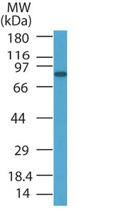 PRDM5 Antibody - Western blot of PRDM5 in HL60 cell lysate using antibody at 1 ug/ml.