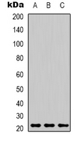 PRDX1 / Peroxiredoxin 1 Antibody - Western blot analysis of Peroxiredoxin 1 expression in MCF7 (A); mouse brain (B); rat kidney (C) whole cell lysates.