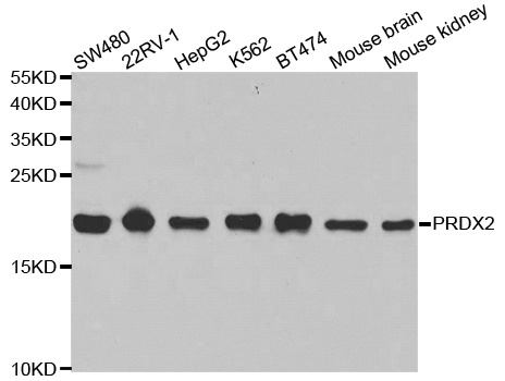 PRDX2 / Peroxiredoxin 2 Antibody - Western blot analysis of extracts of various cell lines, using PRDX2 antibody.