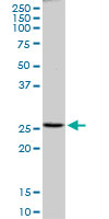 PRDX4 / Peroxiredoxin 4 Antibody - Western blot of PRDX4 expression in human liver.