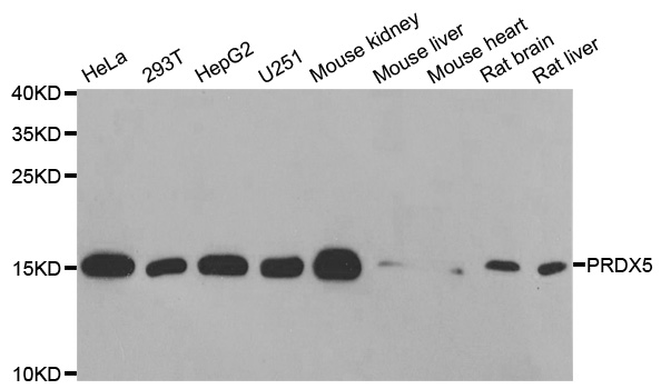 PRDX5 / Peroxiredoxin 5 Antibody - Western blot analysis of extracts of various cell lines, using PRDX5 antibody.