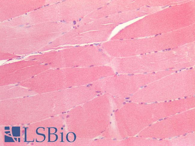 PRDX6 / Peroxiredoxin 6 Antibody - Human Skeletal Muscle: Formalin-Fixed, Paraffin-Embedded (FFPE)