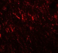 PRICKLE2 Antibody - Immunofluorescence of PRICKLE2 in rat brain cells with PRICKLE2 antibody at 20 µg/mL.