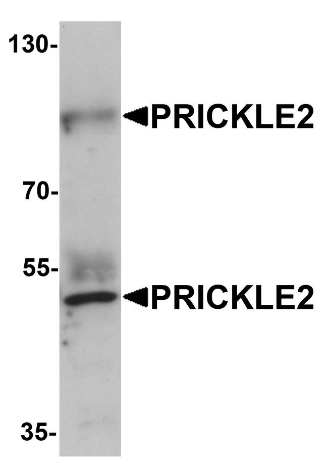 PRICKLE2 Antibody - Western blot analysis of PRICKLE2 in A-20 lysate with PRICKLE2 antibody at 1 ug/ml.