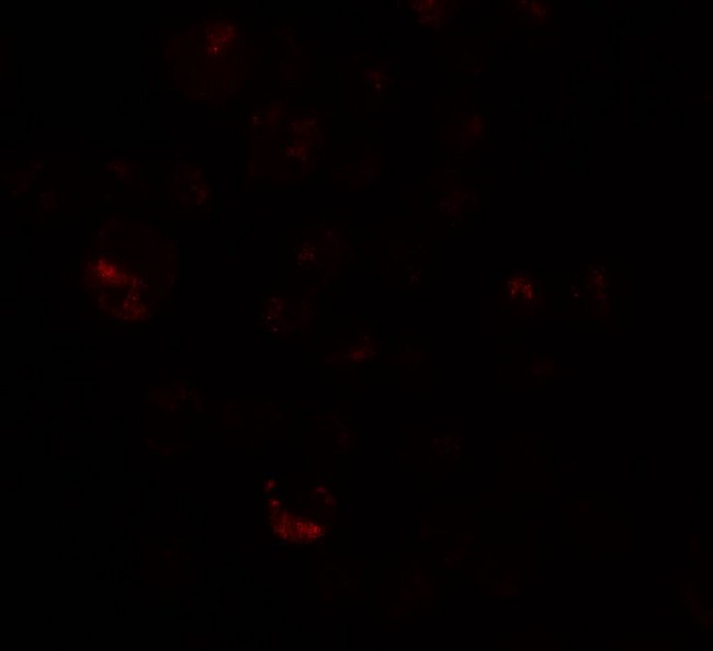 PRICKLE4 Antibody - Immunofluorescence of PRICKLE4 in A549 cells with PRICKLE4 antibody at 20 µg/mL.