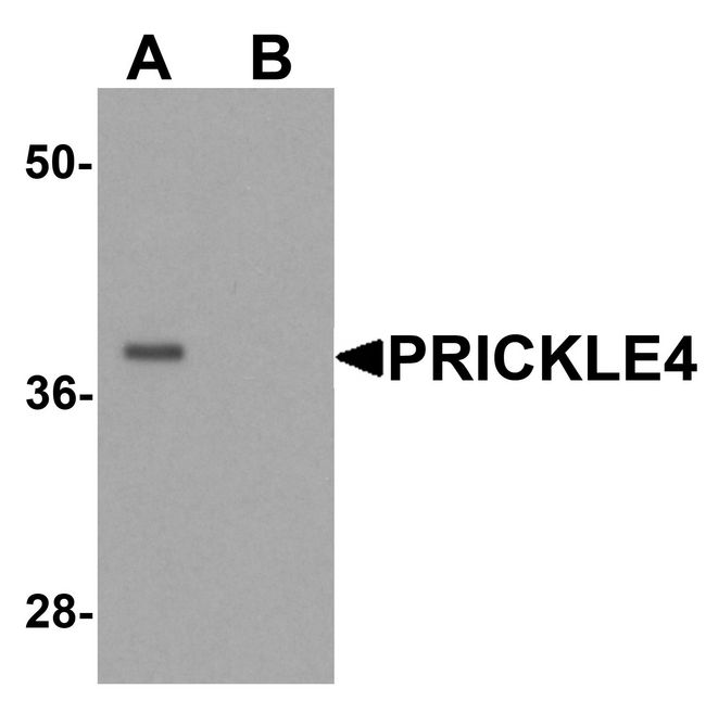 PRICKLE4 Antibody - Western blot analysis of PRICKLE4 in A549 cell lysate with PRICKLE4 antibody at 0.25 ug/ml in the (A) absence and (B) presence of blocking peptide.