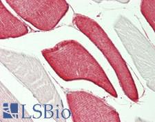 PRKAA1 / AMPK Alpha 1 Antibody - Human Skeletal Muscle: Formalin-Fixed, Paraffin-Embedded (FFPE)