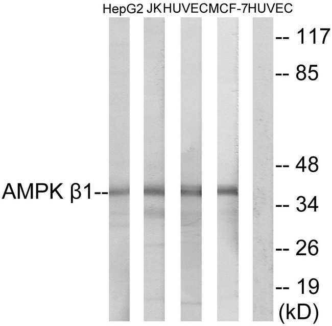 PRKAB1 / AMPK Beta 1 Antibody - Western blot analysis of lysates from HepG2, Jurkat, HUVEC, and MCF-7 cells, using AMPK beta1 Antibody. The lane on the right is blocked with the synthesized peptide.