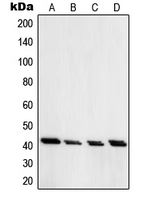 PRKAR1A Antibody - Western blot analysis of PRKAR1A expression in Jurkat (A); HT29 (B); H1299 (C); A549 (D) whole cell lysates.