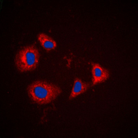 PRKAR1A Antibody - Immunofluorescent analysis of PRKAR1A staining in HT29 cells. Formalin-fixed cells were permeabilized with 0.1% Triton X-100 in TBS for 5-10 minutes and blocked with 3% BSA-PBS for 30 minutes at room temperature. Cells were probed with the primary antibody in 3% BSA-PBS and incubated overnight at 4 C in a humidified chamber. Cells were washed with PBST and incubated with a DyLight 594-conjugated secondary antibody (red) in PBS at room temperature in the dark. DAPI was used to stain the cell nuclei (blue).
