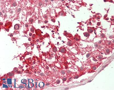 PRKAR1A Antibody - Human Testis: Formalin-Fixed, Paraffin-Embedded (FFPE)