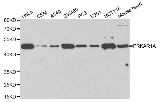 PRKAR1A Antibody - Western blot analysis of extracts of various cell lines using PRKAR1A antibody.