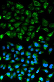 PRKAR1A Antibody - Immunofluorescence analysis of HeLa cell using PRKAR1A antibody. Blue: DAPI for nuclear staining.