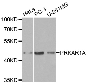 PRKAR1A Antibody - Western blot analysis of extracts of various cell lines, using PRKAR1A antibody at 1:1000 dilution. The secondary antibody used was an HRP Goat Anti-Rabbit IgG (H+L) at 1:10000 dilution. Lysates were loaded 25ug per lane and 3% nonfat dry milk in TBST was used for blocking.