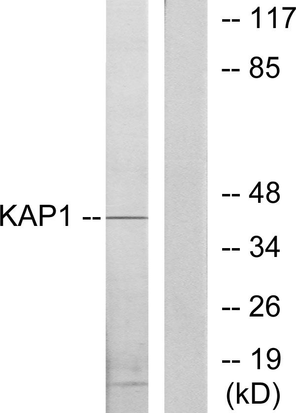 PRKAR1B Antibody - Western blot analysis of lysates from COLO205 cells, using KAP1 Antibody. The lane on the right is blocked with the synthesized peptide.