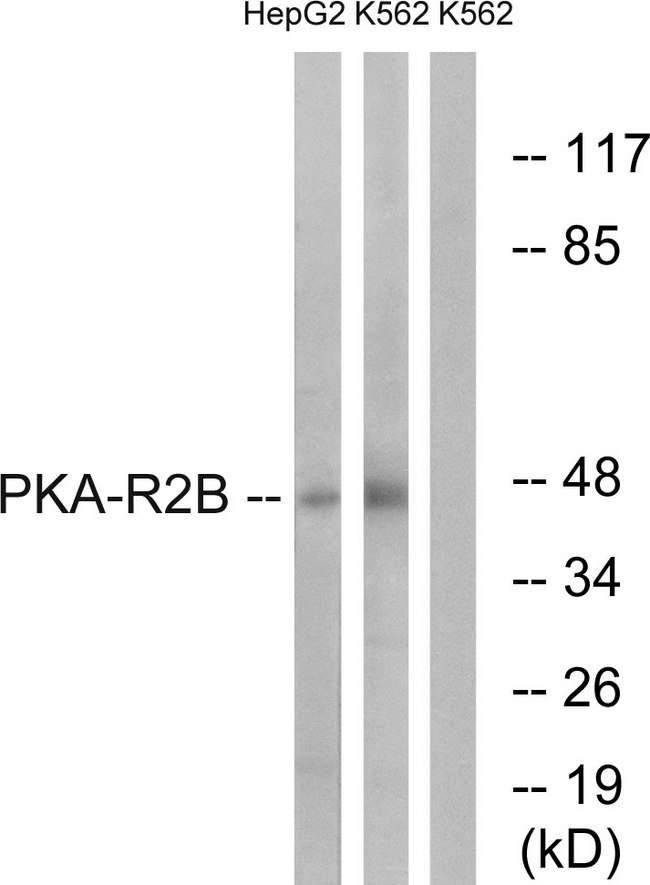 PRKAR2B Antibody - Western blot analysis of lysates from K562 and HepG2 cells, using PKA-R2 beta Antibody. The lane on the right is blocked with the synthesized peptide.