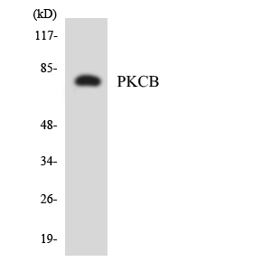 PRKCB / PKC-Beta Antibody - Western blot analysis of the lysates from HepG2 cells using PKCB antibody.