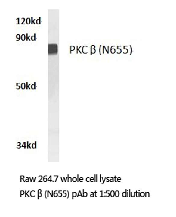 PRKCB / PKC-Beta Antibody - Western blot of PKC (N655) pAb in extracts from RAW264.7 cells.