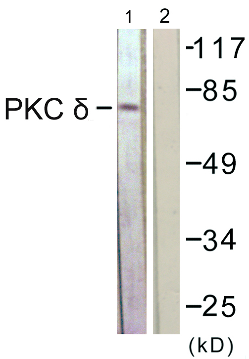 PRKCD / PKC-Delta Antibody - Western blot analysis of lysates from NIH/3T3 cells, treated with UV 15', using PKC delta Antibody. The lane on the right is blocked with the synthesized peptide.
