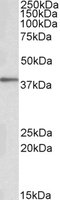 PRKCDBP / CAVIN3 Antibody - PRKCDBP antibody (0.1 ug/ml) staining of Human Adipose cell lysate (35 ug protein/ml in RIPA buffer). Primary incubation was 1 hour. Detected by chemiluminescence.