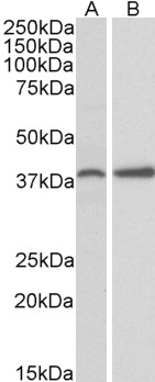 PRKCDBP / CAVIN3 Antibody - PRKCDBP antibody (0.3ug/ml) staining of Mouse Ovary (A) and Rat Uterus (B) lysate (35ug protein in RIPA buffer). Primary incubation was 1 hour. Detected by chemiluminescence.