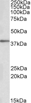 PRKCDBP / CAVIN3 Antibody - PRKCDBP / CAVIN3 antibody (0.1µg/ml) staining of Human Adipose cell llysate (35µg protein in RIPA buffer). Detected by chemiluminescence.