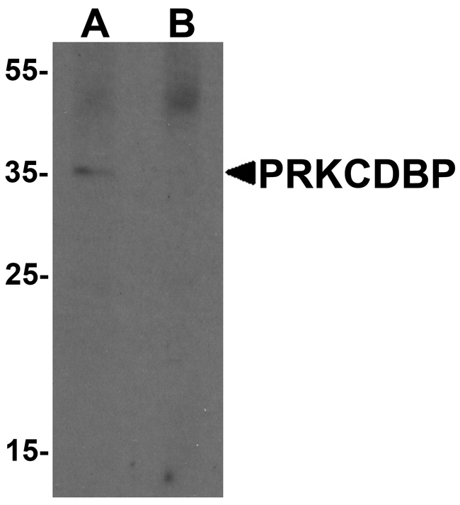 PRKCDBP / CAVIN3 Antibody - Western blot analysis of PRKCDBP in A20 cell lysate with PRKCDBP antibody at 1 ug/ml in (A) the absence and (B) the presence of blocking peptide.