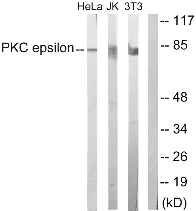 PRKCE / PKC-Epsilon Antibody - Western blot analysis of lysates from HeLa, Jurkat, and 3T3 cells, treated with PMA 125ng/ml 30', using PKC epsilon Antibody. The lane on the right is blocked with the synthesized peptide.