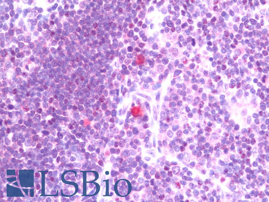 PRKCQ / PKC-Theta Antibody - Anti-PRKCQ / PKC-Theta antibody IHC staining of human thymus. Immunohistochemistry of formalin-fixed, paraffin-embedded tissue after heat-induced antigen retrieval. Antibody dilution 1:200.