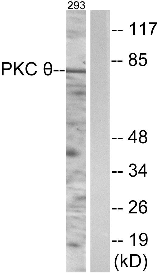 PRKCQ / PKC-Theta Antibody - Western blot analysis of lysates from 293 cells, using PKC thet Antibody. The lane on the right is blocked with the synthesized peptide.