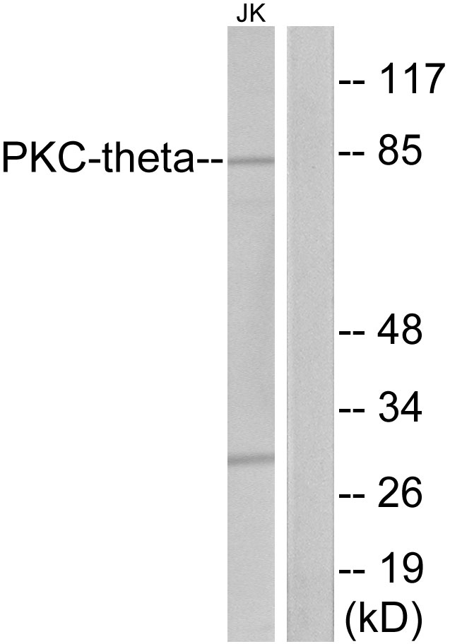 PRKCQ / PKC-Theta Antibody - Western blot analysis of lysates from Jurkat cells, treated with PMA 200nM 30', using PKC thet Antibody. The lane on the right is blocked with the synthesized peptide.