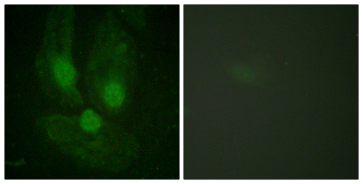 PRKCZ / PKC-Zeta Antibody - Immunofluorescence analysis of HeLa cells, using PKC zeta Antibody. The picture on the right is blocked with the synthesized peptide.