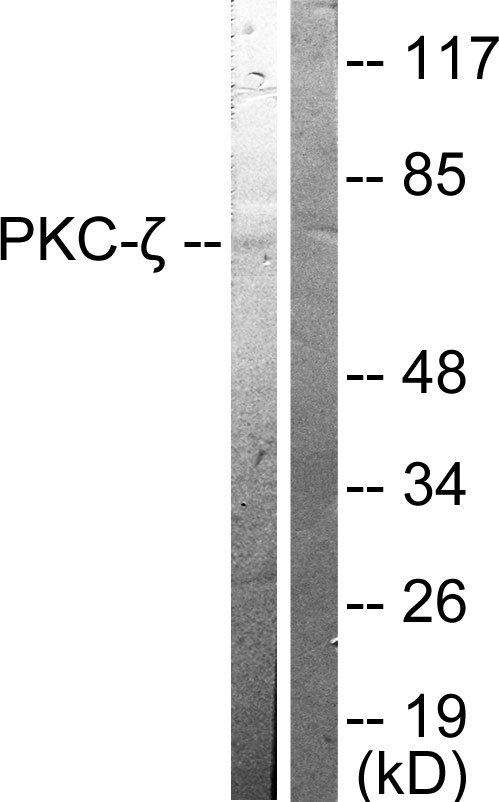 PRKCZ / PKC-Zeta Antibody - Western blot analysis of lysates from NIH/3T3 cells, treated with PMA 125ng/ml 30', using PKC zeta Antibody. The lane on the right is blocked with the synthesized peptide.