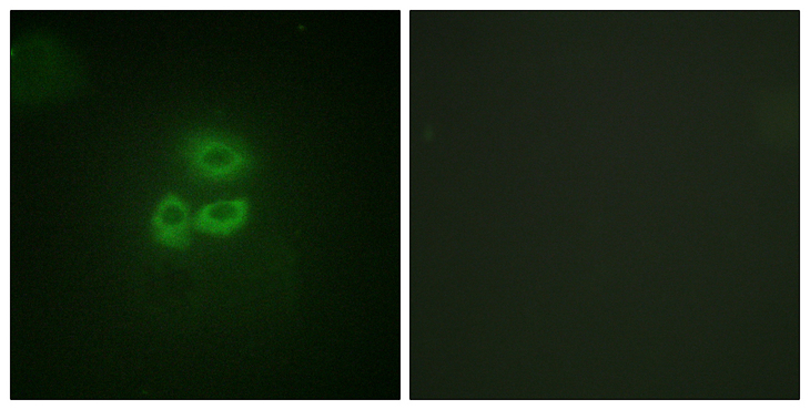 PRKD1 / PKC Mu Antibody - Immunofluorescence analysis of A549 cells, using PKD1/PKC mu Antibody. The picture on the right is blocked with the synthesized peptide.