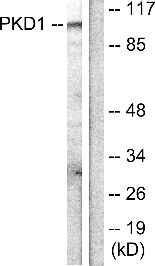 PRKD1 / PKC Mu Antibody - Western blot analysis of lysates from HUVEC cells, treated with PMA 125ng/ml 30', using PKD1/PKC mu Antibody. The lane on the right is blocked with the synthesized peptide.