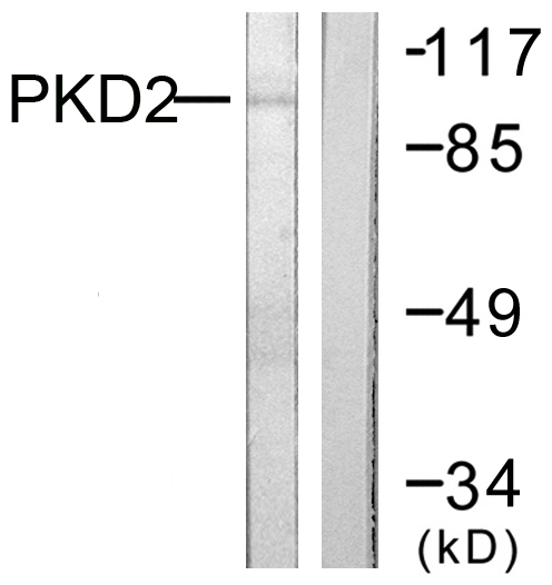 PRKD2 / PKD2 Antibody - Western blot analysis of lysates from NIH/3T3 cells, treated with PMA 250ng/ml 15', using PKD2 Antibody. The lane on the right is blocked with the synthesized peptide.