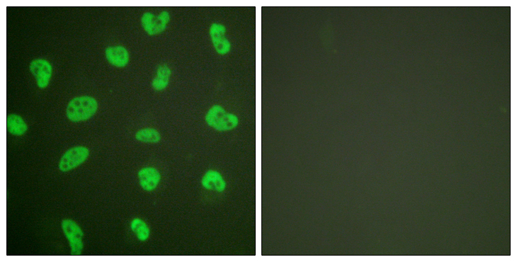 PRKDC / DNA-PKcs Antibody - Immunofluorescence analysis of HeLa cells, using DNA-PK Antibody. The picture on the right is blocked with the synthesized peptide.