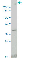 PRKDC / DNA-PKcs Antibody - PRKDC monoclonal antibody clone 1B9 Western blot of PRKDC expression in A-431.