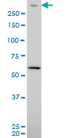 PRKDC / DNA-PKcs Antibody - PRKDC monoclonal antibody clone 2A8 Western blot of PRKDC expression in HeLa NE.