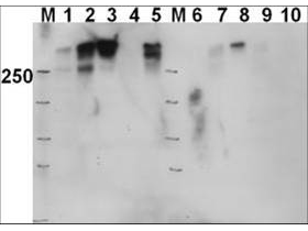 PRKDC / DNA-PKcs Antibody - Anti-DNAPKcs Antibody - Western Blot. Western blot of Affinity Purified anti-DNAPKcs antibody shows detection of a 460 kD band corresponding to human DNAPKcs in various preparations. Lane 1: Fus1 untreated, Lane 2: Fus1 IR (20Gy, 4h), Lane 3: Fus1 DNAPK inhibitor + IR, Lane 4: MO59J (DNAPK-) untreated, Lane 5: MO59J IR, Lane 6: Fus1 untreated, Lane 7: Fus1 IR (20Gy, 4h), Lane 8: Fus1 DNAPK inhibitor + IR, Lane 9: MO59J untreated, Lane 10: MO59J IR. Lanes 1-5 are nuclear extract whereas lanes 6-10 are whole cell lysates. MO59J is a cell line that lacks DNA-PKcs. FUS1 is the matched cell line complemented with a chromosomal fragment containing the DNA-PKcs gene. Approximately 20 ug of lysate was run on SDS-PAGE and transferred onto nitrocellulose, followed by reaction with a 1:1000 dilution of anti-DNAPKcs antibody. Detection occurred using a 1:5000 dilution of HRP-labeled Goat anti-Rabbit IgG for 1 hour at room temperature. A chemiluminescence system was used for signal detection (Roche) using a 1 min exposure time.