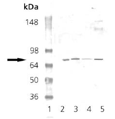 PRKG Antibody - Western Blot Analysis: Lane 1: MWM, Lane 2: Mouse Brain Tissue Extract, Lane 3: Rat Brain Tissue Extract, Lane 4: EKS4 Cell Lysate; Lane 5: H S67 Cell Lysate probed with PKG polyclonal antibody.