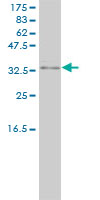 PRKRA / PACT Antibody - PRKRA monoclonal antibody, clone 1B9-1A7. Western blot of PRKRA expression in human liver.