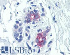 PRLR / Prolactin Receptor Antibody - Anti-Prolactin Receptor antibody IHC of human breast. Immunohistochemistry of formalin-fixed, paraffin-embedded tissue after heat-induced antigen retrieval. Antibody concentration 5 ug/ml.