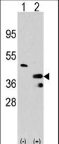 PRMT1 Antibody - Western blot of PRMT1 (arrow) using rabbit polyclonal PRMT1 Antibody (RB00005). 293 cell lysates (2 ug/lane) either nontransfected (Lane 1) or transiently transfected with the PRMT1 gene (Lane 2) (Origene Technologies).