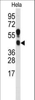 PRMT1 Antibody - Western blot of anti-PRMT1 Antibody (C-term K342) in HeLa cell line lysates (35 ug/lane). PRMT1 (arrow) was detected using the purified antibody.