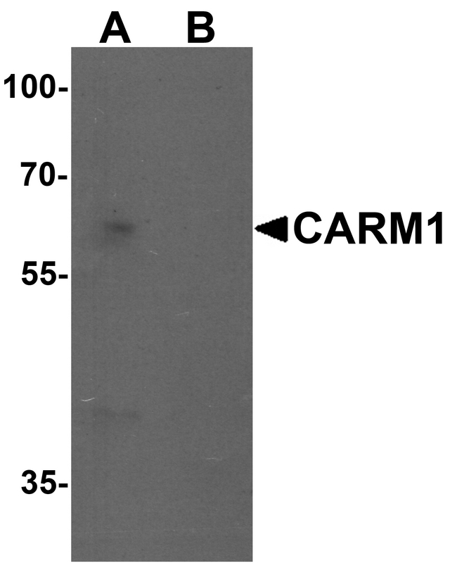 PRMT4 / CARM1 Antibody - Western blot analysis of CARM1 in Jurkat cell lysate with CARM1 antibody at 1 ug/ml in (A) the absence and (B) the presence of blocking peptide.