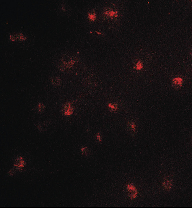 PRMT4 / CARM1 Antibody - Immunofluorescence of CARM1 in Jurkat cells with CARM1 antibody at 5 ug/ml.