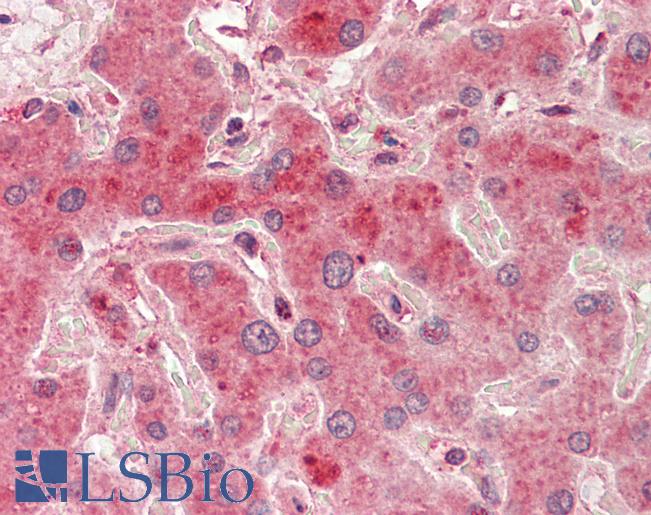 PRMT7 Antibody - Anti-PRMT7 antibody IHC staining of human liver. Immunohistochemistry of formalin-fixed, paraffin-embedded tissue after heat-induced antigen retrieval. Antibody concentration 5 ug/ml.