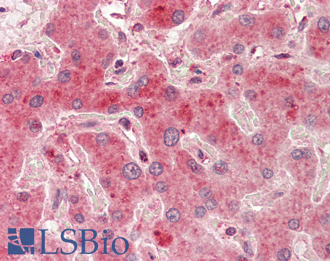 PRMT7 Antibody - Anti-PRMT7 antibody IHC staining of human liver. Immunohistochemistry of formalin-fixed, paraffin-embedded tissue after heat-induced antigen retrieval. Antibody concentration 5 ug/ml.