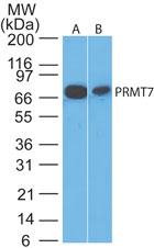 PRMT7 Antibody - Western blot of PRMT7 in (A) HeLa and (B)?NIH 3T3?cell lysate using antibody at 0.5 ug/ml.